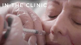 First-Time Botox and Fillers in late 50s | In the Clinic: Before and Afters | Fiona