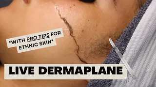 Dermaplanes on Ethnic skin types! PRO TIPS!