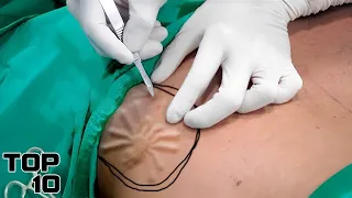 Top 10 Disturbing Things Doctors Have Seen In Surgery
