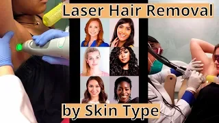 Laser Hair Removal by Skin Type [Dr. Ellern Explains How to Make Yours Safe & Effective]