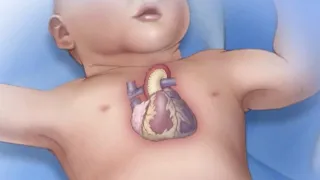 Mayo Clinic Minute: Congenital heart disease and pregnancy