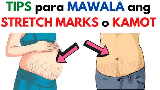 Paano matanggal ang Stretch Marks  o  KAMOT? Gamot at paraan para mawala / home remedies PEKLAT