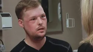 Face transplant for man who tried to take his own life
