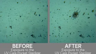 UV Care UVC Light Before and After Microscope