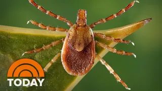 New meat allergy linked to tick bite: What you need to know