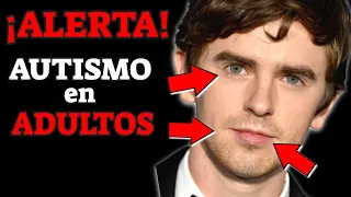 SINTOMAS de ALERTA de AUTISMO en ADULTOS que NO DEBES IGNORAR| SINDROME DE ASPERGER