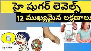 Top 12 Signs that you have High Blood Sugar Levels (Telugu)