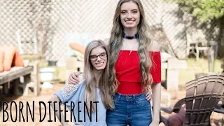 My Identical Twin With Dwarfism | BORN DIFFERENT