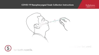 COVID-19 Nasopharyngeal Swab Collection Instructions | BioReference Laboratories