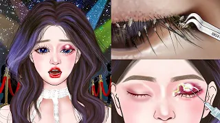 ASMR Dirty Eyelashes Lice & Big Acne Removal | Deep Cleaning Animation #4