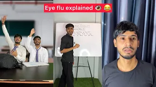 Eye flu explained👁️❤️❌❌|chimkandi