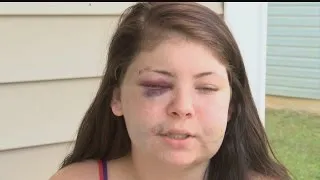 Woman says ex-boyfriend nearly beat her to death