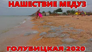 ОПАСНОСТЬ! МНОГО МЕДУЗ В АЗОВСКОМ МОРЕ, ГОЛУБИЦКАЯ - ЧТО ДЕЛАТЬ, ЕСЛИ ВАС УЖАЛИЛ КОРНЕРОТ?