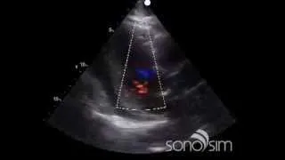 SonoSim Ultrasound Challenge - RUSH Protocol