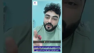 نتيجة صادمة ❇️ كيف صار الحال بعد ٣ سنوات من عمل إبتسامة هوليود 🧐✅✅✅✅✅