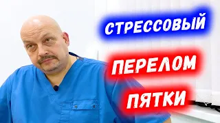 Болит пятка причины | Стрессовый перелом пятки | Григорий Перевезенцев