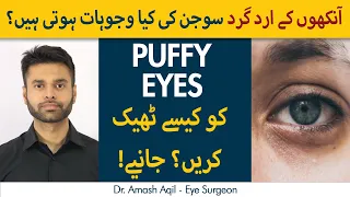 Ankhon ki Sujan Ka Ilaj  | Puffiness In Eyes : Causes and Treatment in Urdu/Hindi