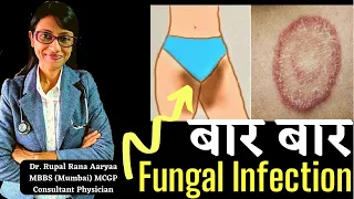 Private Parts 🤫 mein baar baar FUNGAL INFECTION hota hai 😞,TREATMENT of RECURRENT FUNGAL INFECTION