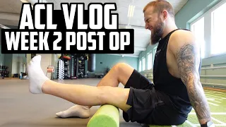 ACL VLOG | 2 Weeks Post ACL Surgery + REMOVING BANDAGES!