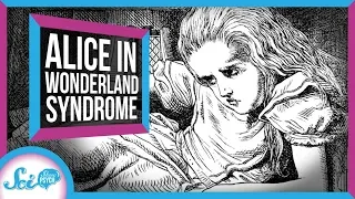 Alice in Wonderland Syndrome