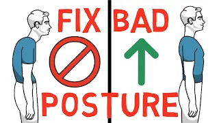 How to INSTANTLY Fix Your Posture - Alexander Technique