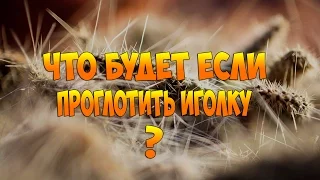 Что будет если проглотить ИГОЛКУ ?