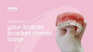 What To Do If Your Braces Bracket Comes Loose | Braces Tips