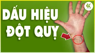 Hơn 99% Người BỊ ĐỘT QUỴ Đều Có 2 Dấu Hiệu Này | Nên Biết Trước Để Ngăn Ngừa Đột Quỵ Tai Biến | TCL