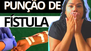 COMO REALIZAR A Punção de uma Fístula para Hemodiálise? #nasctreinamentosenfermagem #enfermagem