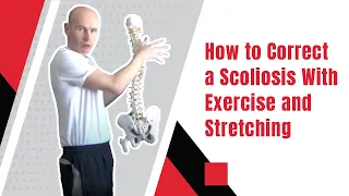How to Correct a Scoliosis With Exercise and Stretching | Edward Paget