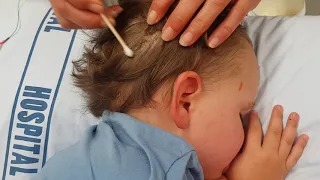 Three year old gets an EEG Electroencephalogram - what to expect