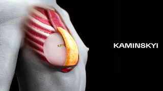 Round implants under the muscle / KAMINSKYI