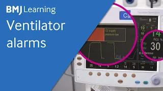 Ventilator alarms | BMJ Learning