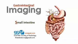 6 Small intestine Imaging -  Prof.Mamdouh mahfouz (2019 edition)