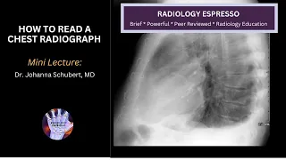 HOW TO READ A CHEST RADIOGRAPH: Mini Lecture, Dr. Johanna Schubert, MD