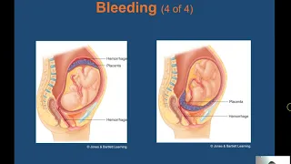 Ch  33 Obstetrics & Neonatal Care