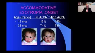 Accommodative Esotropia and its Complications