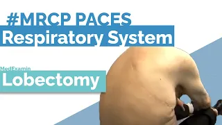 Right Lobectomy - Cases for PACES - MRCP PACES Station 1