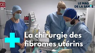 Fibrome utérin : quand il faut opérer - Le Magazine de la Santé