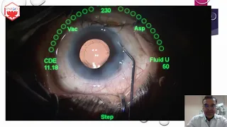 PACS Presentation by Dr Gaurav Luthra - Know more about the application of Phenocaine Plus and PACS