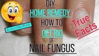 DIY Fingernail Fungus Treatment- Home Remedy - Please read the description #101