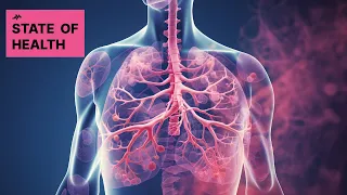 Amivantamab: A New Hope for Lung Cancer Patients