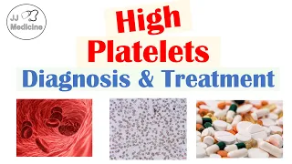 What is Thrombocytosis? Diagnosis & Treatment of High Platelets | Rapid Review