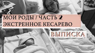 моя история родов | кесарево сечение | роды в ирландии