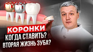 🦷🤔Коронки: ГРОБ для зубов или вторая жизнь? Когда пора устанавливать? Какие выбрать?😊🦷