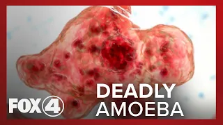 Potentially Deadly Amoeba Infected a Person in Charlotte County Through Tap Water