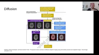 Overview of prospective motion detection and correction methods in neuroimaging by Dr. Paul Wighton