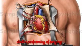 Doctor Performing Surgery on a Heart in the Body