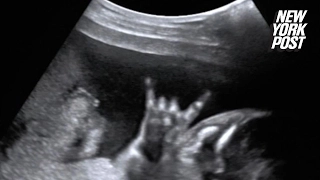 Baby makes rock-and-roll sign during ultrasound scan