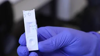 Tests rapides antigéniques : un dispositif complémentaire à la PCR pour un dépistage de la Covid-19